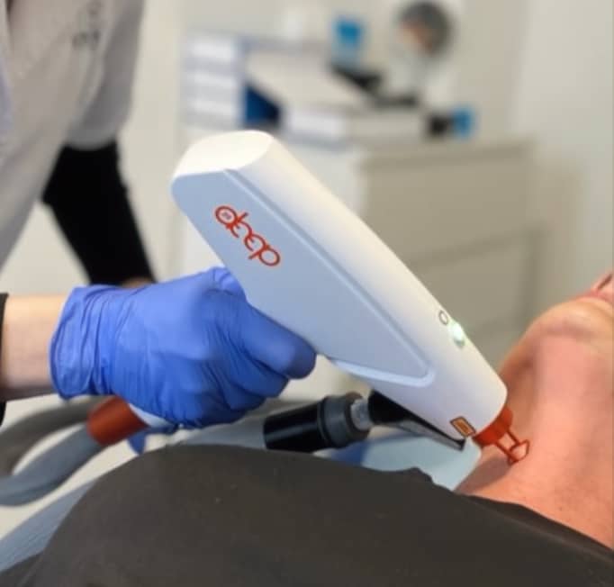 Laser fractionné ProDeep® est un laser de dernière génération pour le traitement des cicatrices, pores dilatés, ridules et de l'acné.