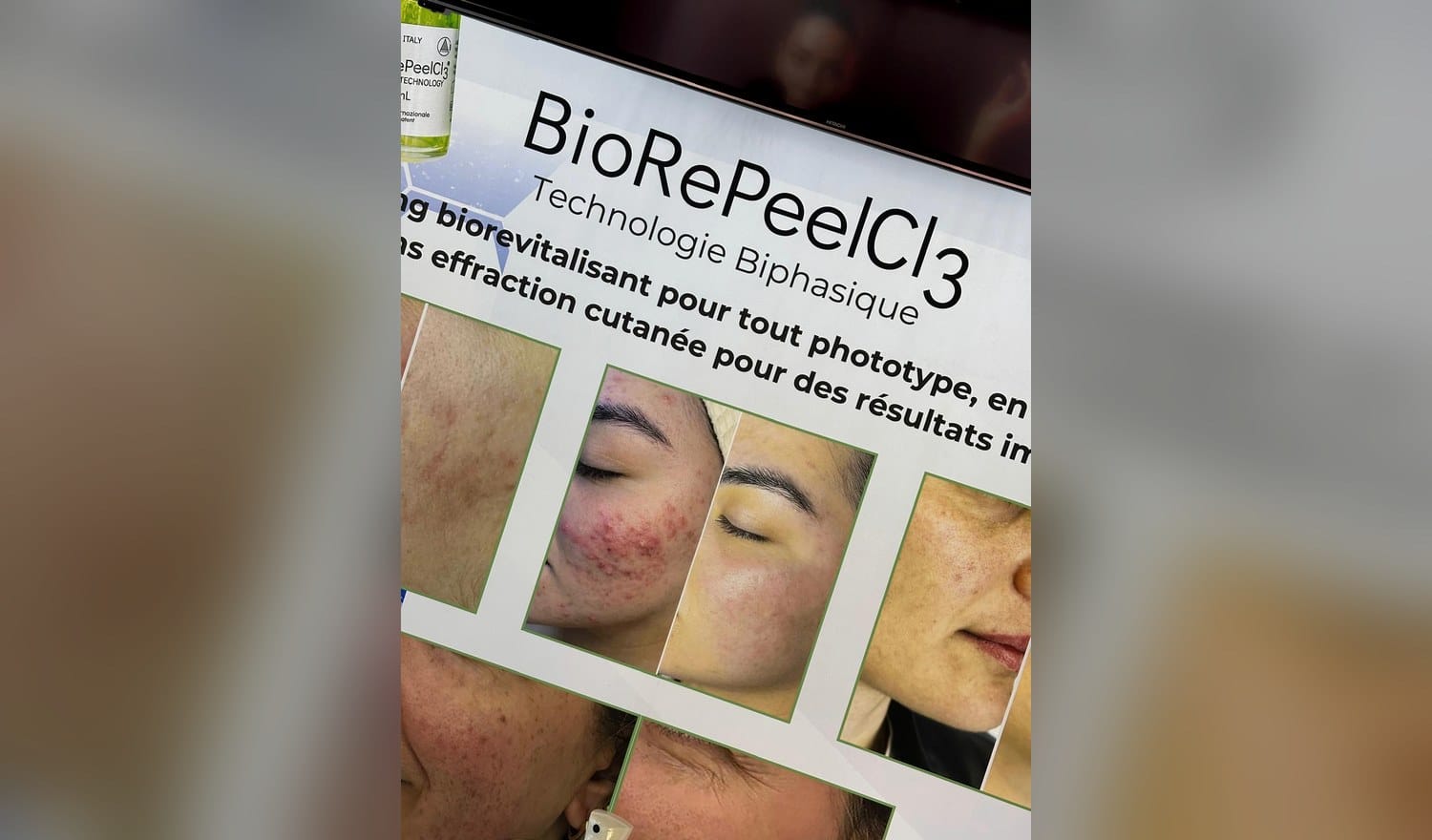 Biorevitalisation à la Maison Andromède, Génissac